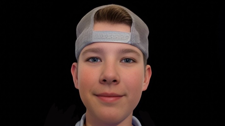 Albin Skin